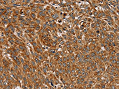 PLEKHG6 Antibody