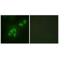AKAP3 Antibody