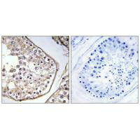 BAGE3 Antibody