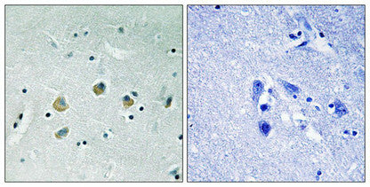 Phospho-MAP3K8 (Ser400) Antibody