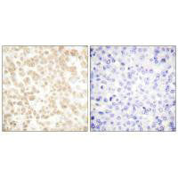 FOSL2 Antibody