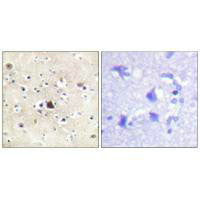 NR3C1 (Ab-226) Antibody