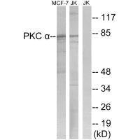PRKCA (Ab-657) Antibody