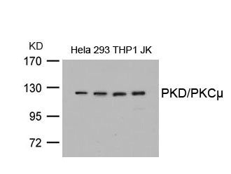 PRKD1 (Ab-738) Antibody