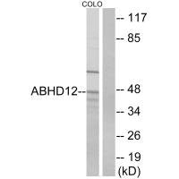 ABHD12 Antibody
