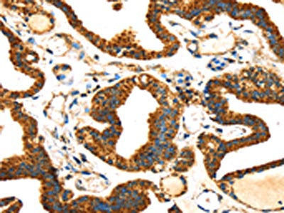 SLC25A26 Antibody