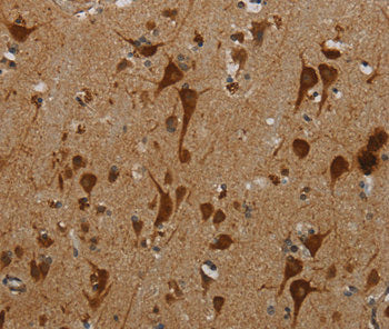 KMT2B Antibody
