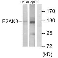 EIF2AK3 Antibody