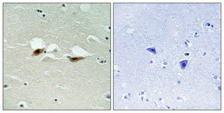 Phospho-ATF2 (Ser472) Antibody
