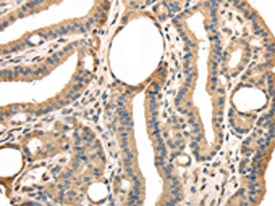 TRIB3 Antibody