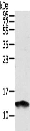 S100A11 Antibody