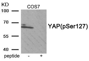 Phospho-YAP1 (Ser127) Antibody
