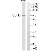 SSH3 Antibody