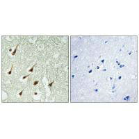 PRKCQ Antibody