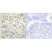 DNMT3B Antibody