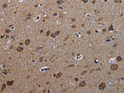 GSTA3 Antibody