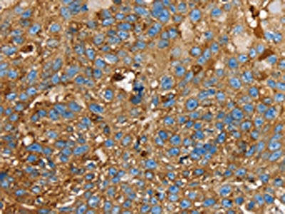 LGALS3BP Antibody