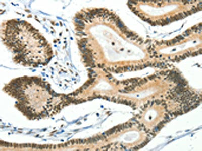 BCAS2 Antibody