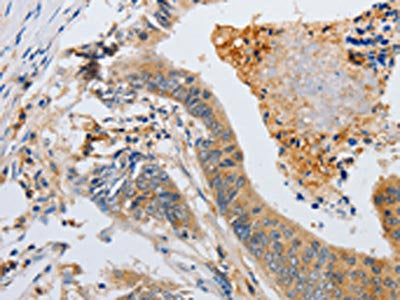 SLC2A5 Antibody