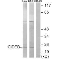 CIDEB Antibody