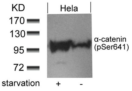Phospho-CTNNA1 (Ser641) Antibody