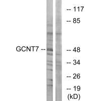 GCNT7 Antibody