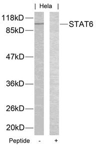 STAT6 (Ab-645) Antibody