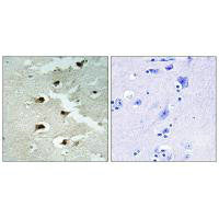 CDCA4 Antibody