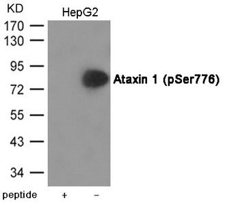 Phospho-ATXN1 (Ser776) Antibody