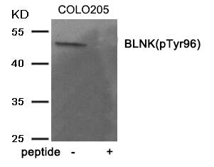 Phospho-BLNK (Tyr96) Antibody