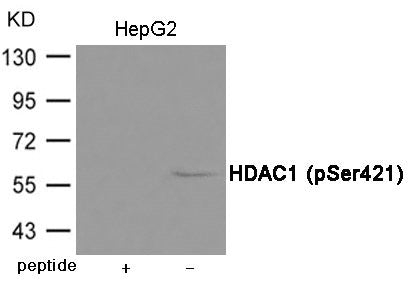 Phospho-HDAC1 (Ser421) Antibody