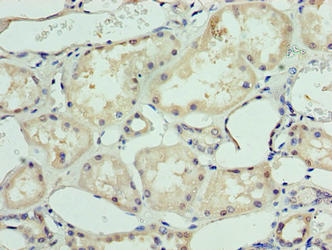 DHX9 Antibody