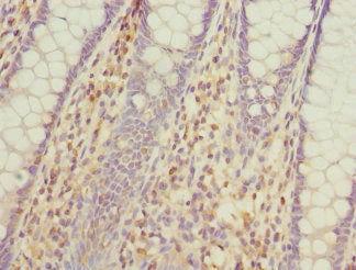 GALNT2 Antibody