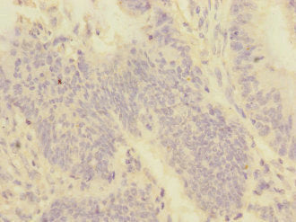 PMPCA Antibody