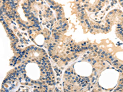 TPSB2 Antibody