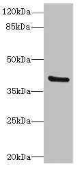 TMOD4 Antibody