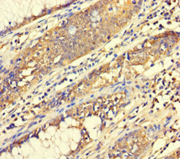 ABHD18 Antibody