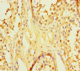 ZNF252P-AS1 Antibody