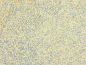 PTPRJ Antibody
