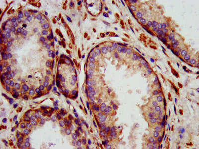 IL24 Antibody
