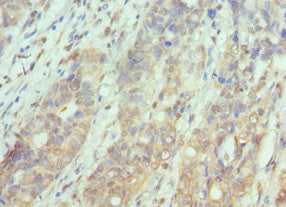 PAK1 Antibody