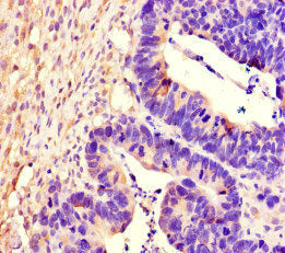 PTPRS Antibody