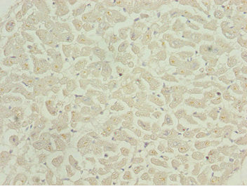 CAMK2D Antibody