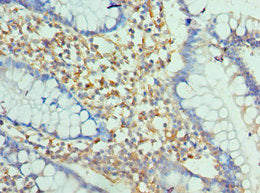 ENPP2 Antibody