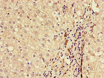 BAAT Antibody