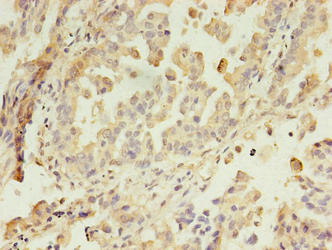 GIT2 Antibody