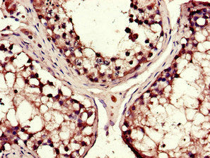 DYNC1H1 Antibody