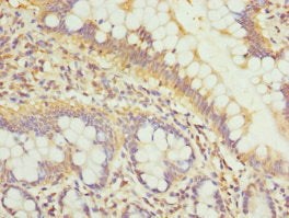 GALNT3 Antibody