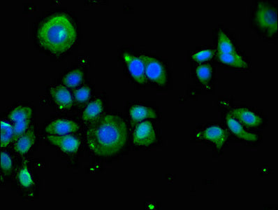 KIR2DS3 Antibody