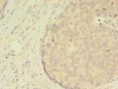 ATXN7L3 Antibody